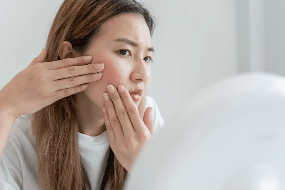 Understanding Sensitive Skin and Redness